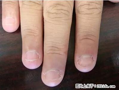 剪指甲、挖耳屎，这些日常小动作竟隐藏大危害！ - 图木舒克生活资讯 - 图木舒克28生活网 tmsk.28life.net